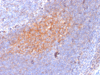 Anti-CD81 antibody [1.3.3.22] used in IHC (Paraffin sections) (IHC-P). GTX34568