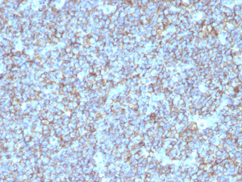 Anti-CD99 antibody [SPM596] used in IHC (Paraffin sections) (IHC-P). GTX34574