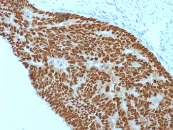 Anti-CDX2 antibody [CDX2/1690] used in IHC (Paraffin sections) (IHC-P). GTX34585