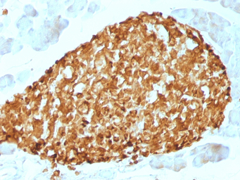 Anti-Chromogranin A antibody [CHGA/798] used in IHC (Paraffin sections) (IHC-P). GTX34599