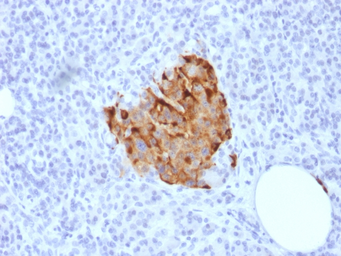 Anti-Chromogranin A antibody [CHGA/1773R] used in IHC (Paraffin sections) (IHC-P). GTX34602
