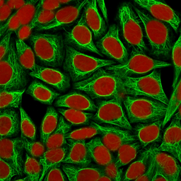 Anti-Cytokeratin 18 antibody [KRT18/1190] used in Immunocytochemistry/ Immunofluorescence (ICC/IF). GTX34637
