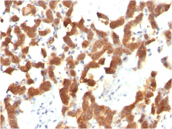 Anti-Cytokeratin 18 antibody [KRT18/834] used in IHC (Paraffin sections) (IHC-P). GTX34642