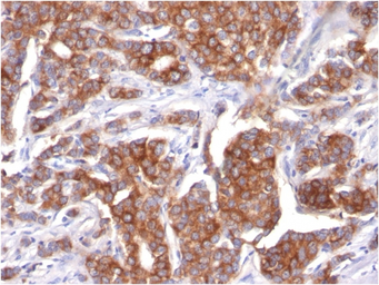 Anti-Cytokeratin 18 antibody [KRT18/834] used in IHC (Paraffin sections) (IHC-P). GTX34642