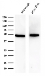 Anti-Cytokeratin 18 antibody [KRT18/834] used in Western Blot (WB). GTX34642