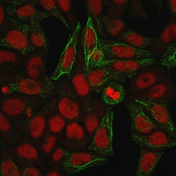 Anti-Cytokeratin 7 antibody [KRT7/903] used in Immunocytochemistry/ Immunofluorescence (ICC/IF). GTX34658