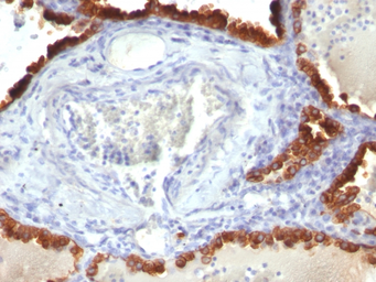 Anti-Cytokeratin 7 antibody [KRT7/760] used in IHC (Paraffin sections) (IHC-P). GTX34659