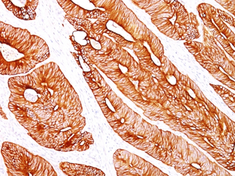 Anti-Cytokeratin 8 antibody [K8/383] used in IHC (Paraffin sections) (IHC-P). GTX34666