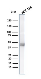 Anti-Cytokeratin 8 antibody [K8.8] used in Western Blot (WB). GTX34670
