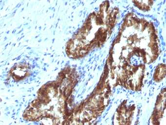 Anti-EAPII antibody [TDP2/1258] used in IHC (Paraffin sections) (IHC-P). GTX34678