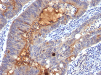 Anti-ECM1 antibody [SPM217] used in IHC (Paraffin sections) (IHC-P). GTX34683