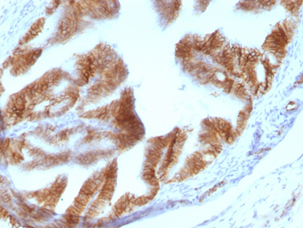 Anti-EpCAM antibody [EGP40/1110] used in IHC (Paraffin sections) (IHC-P). GTX34691