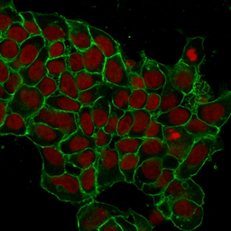 Anti-EpCAM antibody [EGP40/1372] used in Immunocytochemistry/ Immunofluorescence (ICC/IF). GTX34694