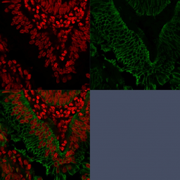 Anti-EpCAM antibody [EGP40/1372] used in IHC (Paraffin sections) (IHC-P). GTX34694