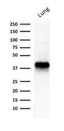 Anti-EpCAM antibody [EGP40/1373] used in Western Blot (WB). GTX34695