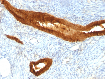 Anti-EpCAM antibody [MOC-31] used in IHC (Paraffin sections) (IHC-P). GTX34700