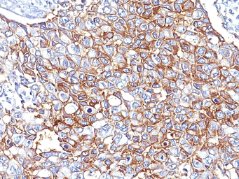 Anti-EpCAM antibody [EGP40/826] used in IHC (Paraffin sections) (IHC-P). GTX34704