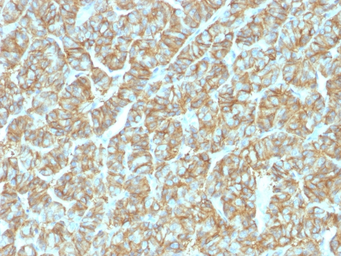 Anti-EpCAM antibody [EGP40/1555R] used in IHC (Paraffin sections) (IHC-P). GTX34707