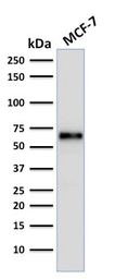 Anti-Estrogen Receptor alpha antibody [ER506] used in Western Blot (WB). GTX34710