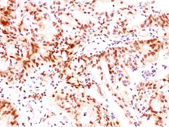 Anti-Estrogen Receptor beta antibody [ERb455] used in IHC (Paraffin sections) (IHC-P). GTX34711