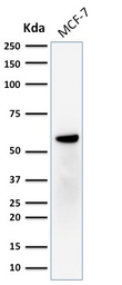Anti-Estrogen Receptor beta antibody [ERb455] used in Western Blot (WB). GTX34711