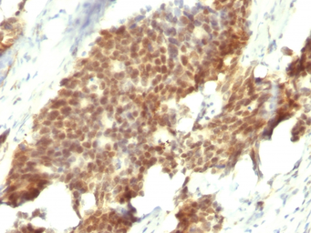 Anti-Estrogen Receptor beta antibody [ESR2/686] used in IHC (Paraffin sections) (IHC-P). GTX34712