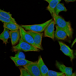 Anti-Fascin 1 antibody [SPM133] used in Immunocytochemistry/ Immunofluorescence (ICC/IF). GTX34719