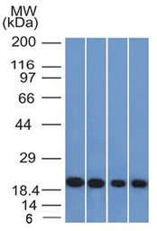 Anti-Ferritin Light Chain antibody [FTL/1386] used in Western Blot (WB). GTX34722