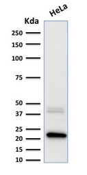 Anti-Ferritin Light Chain antibody [FTL/1389] used in Western Blot (WB). GTX34724