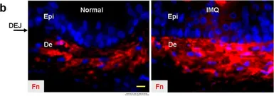 Anti-Fibronectin antibody [TV-1] used in IHC (Paraffin sections) (IHC-P). GTX34727