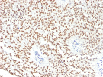 Anti-FOXA1 antibody [FOXA1/1241] used in IHC (Paraffin sections) (IHC-P). GTX34735