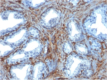 Anti-Galectin 1 antibody [GAL1/1831] used in IHC (Paraffin sections) (IHC-P). GTX34746