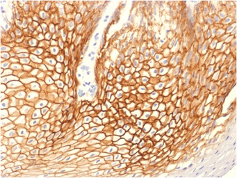 Anti-gamma Catenin antibody [CTNG/1664] used in IHC (Paraffin sections) (IHC-P). GTX34752