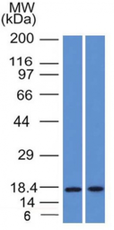 Anti-GCDFP15 antibody [PIP/1571] used in Western Blot (WB). GTX34753