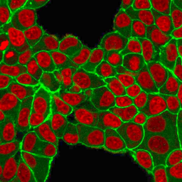 Anti-Her2 / ErbB2 antibody [HRB2/451] used in Immunocytochemistry/ Immunofluorescence (ICC/IF). GTX34780