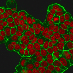 Anti-Her2 / ErbB2 antibody [HRB2/451] used in Immunocytochemistry/ Immunofluorescence (ICC/IF). GTX34780