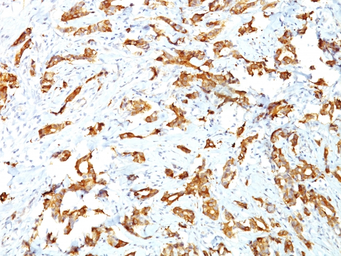 Anti-HSP27 antibody [G3.1] used in IHC (Paraffin sections) (IHC-P). GTX34784