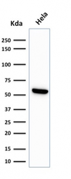 Anti-HSP60 antibody [LK1] used in Western Blot (WB). GTX34785