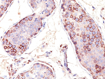 Anti-MAGE 1 antibody [SPM282] used in IHC (Paraffin sections) (IHC-P). GTX34810