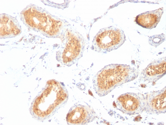 Anti-Melanoma gp100 antibody [HMB45] used in IHC (Paraffin sections) (IHC-P). GTX34833