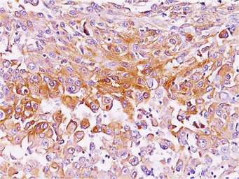 Anti-Melanoma gp100 antibody [NKI-beteb] used in IHC (Paraffin sections) (IHC-P). GTX34835