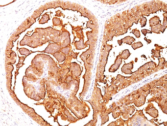 Anti-MUC1 antibody [MUC1/520] used in IHC (Paraffin sections) (IHC-P). GTX34855