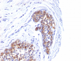 Anti-MUC1 antibody [MUC1/520] used in IHC (Paraffin sections) (IHC-P). GTX34855