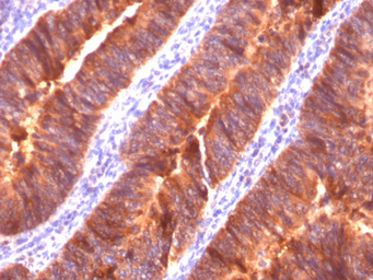 Anti-MUC1 antibody [MUC1/520] used in IHC (Paraffin sections) (IHC-P). GTX34855