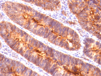 Anti-MUC1 antibody [MUC1/845] used in IHC (Paraffin sections) (IHC-P). GTX34859