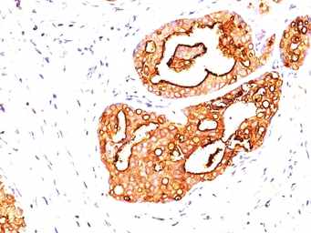 Anti-MUC1 antibody [139H2] used in IHC (Paraffin sections) (IHC-P). GTX34860
