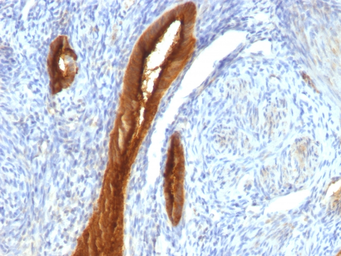 Anti-MUC1 antibody [139H2] used in IHC (Paraffin sections) (IHC-P). GTX34860