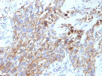 Anti-NCAM antibody [NCAM1/795] used in IHC (Paraffin sections) (IHC-P). GTX34894