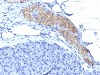 Anti-NCAM antibody [NCAM1/795] used in IHC (Paraffin sections) (IHC-P). GTX34894