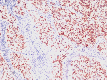 Anti-NKX2.1 antibody [SPM150] used in IHC (Paraffin sections) (IHC-P). GTX34905